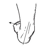 posterior tibial tendon